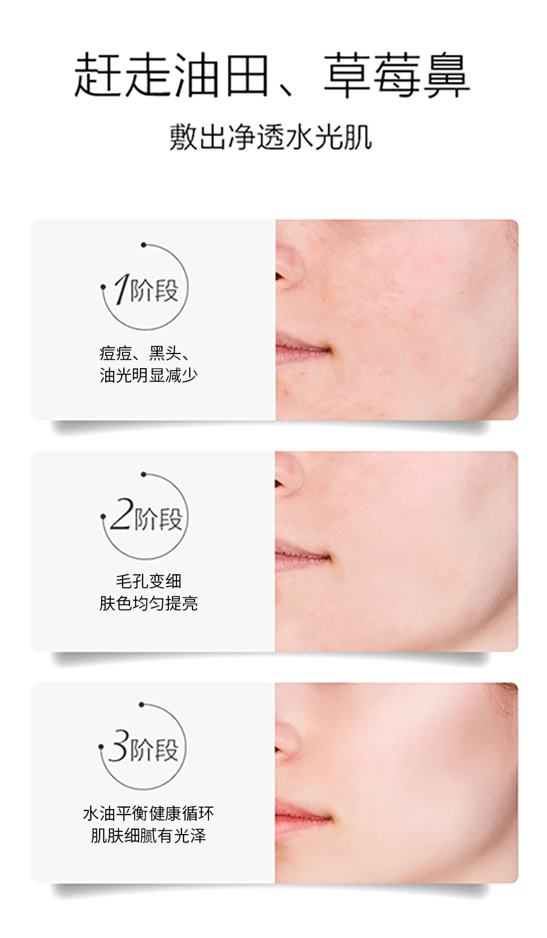 RYDEEN 白泥清洁面膜125g 深层清洁收缩毛孔提补水控油涂抹式面膜泥 【2瓶装】白泥清洁面膜125g