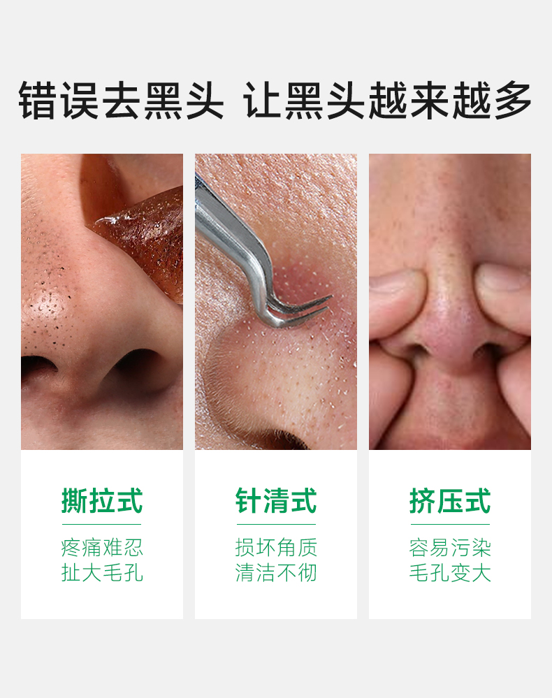 CCA去黑头套盒鼻贴5组10片导出精华液吸粉刺面膜贴收缩毛孔不撕拉温和男女 COCOAMELIA CCA去黑头鼻贴【免撕拉