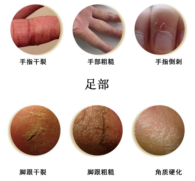 隆力奇 蛇油膏26g袋 防干燥防皴滋润保湿全身使用 30袋