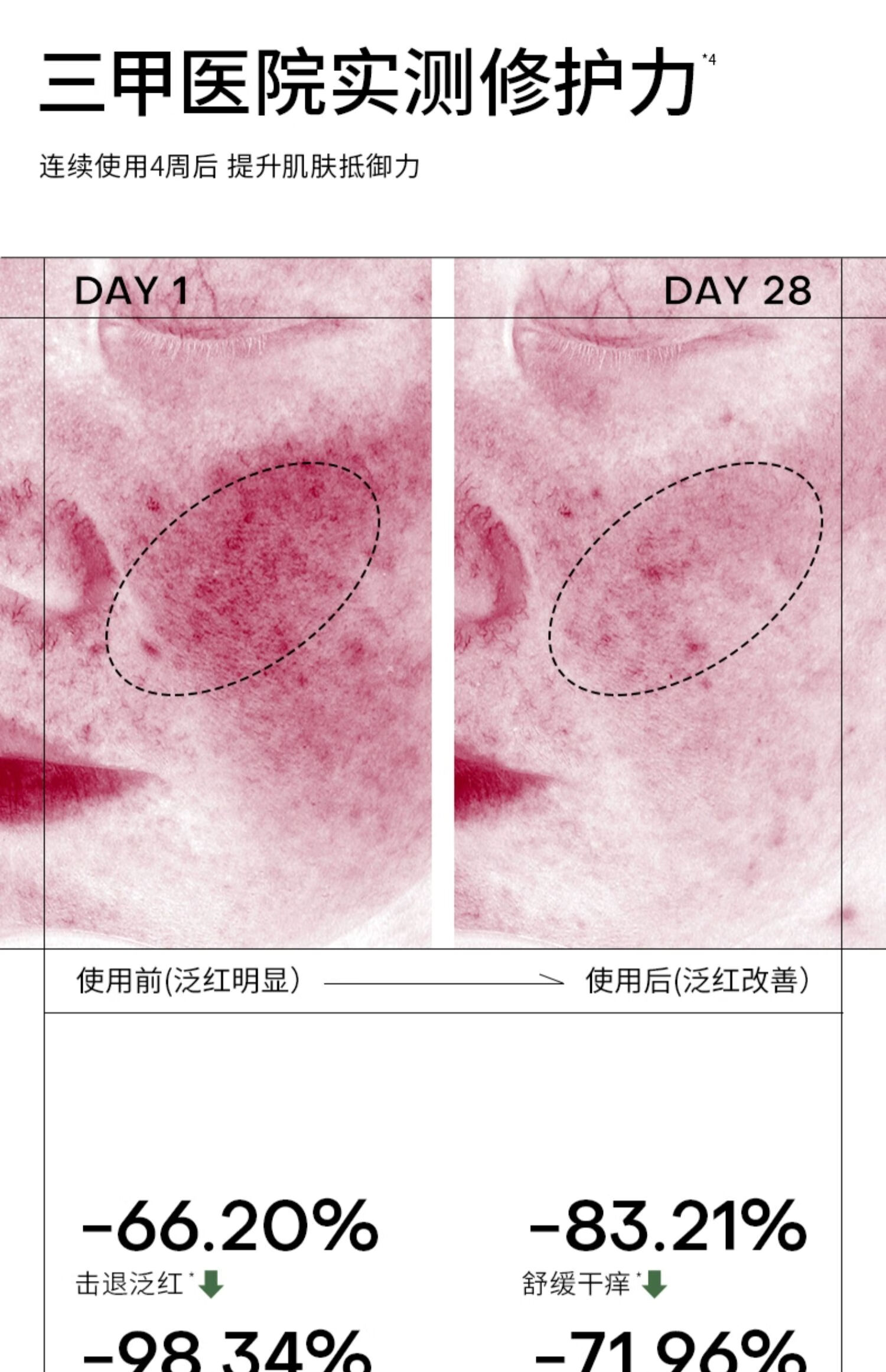 安敏优青蒿次抛修护精华液补水保湿舒缓退红维稳强韧屏障30支/盒 【小白管】维稳精华