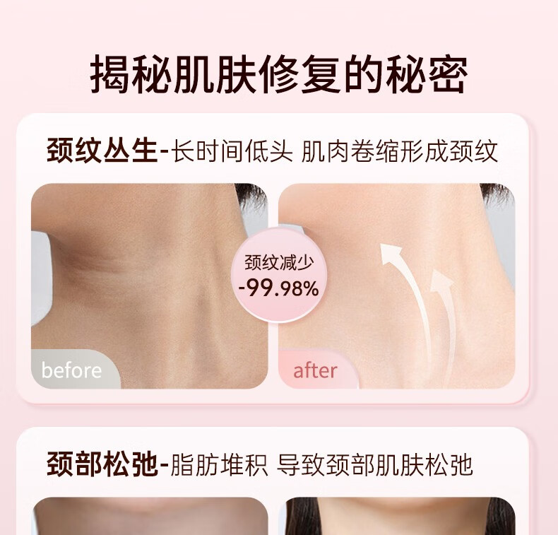 妮丽雅颈膜固定带兔子款颈部面膜固定带淡化颈纹凝胶颈贴护理提拉敷脖子 颈膜兔子款粉色+面膜贴100张
