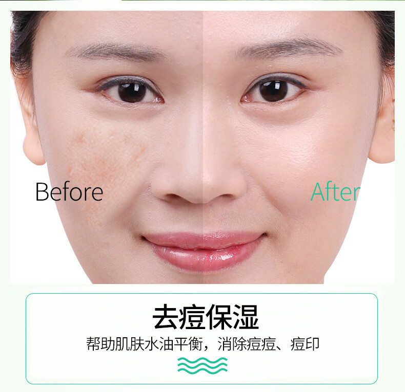 韩婵【发5支】水润芦荟胶补水保湿女男士通用晒后护理痘痘肌可用 40g/支