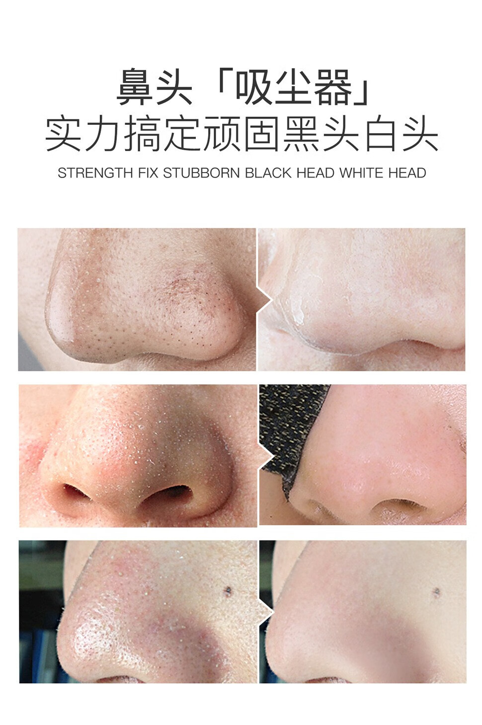 泊泉雅去黑头套装竹炭撕拉式面膜膏吸附黑头粉刺白头导出液鼻贴T区护理 撕拉式面膜膏