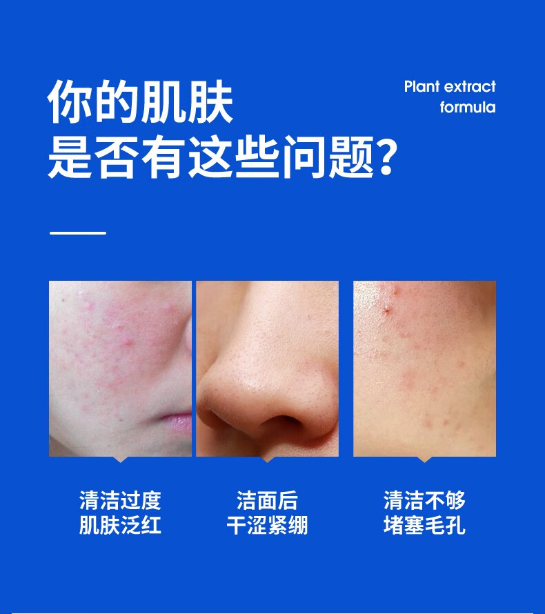 满婷（MANTING）青花椒控油洁面膏100g除螨洁面控油祛痘皂男女士