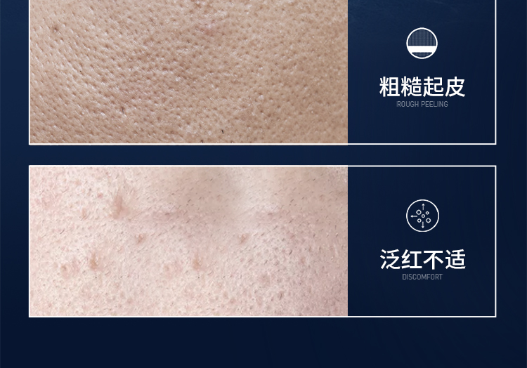 梵贞 男士护肤礼盒 补水保湿控油洗面奶擦脸油精华水乳套装学生护肤品 男士劲肤清爽三件套礼盒
