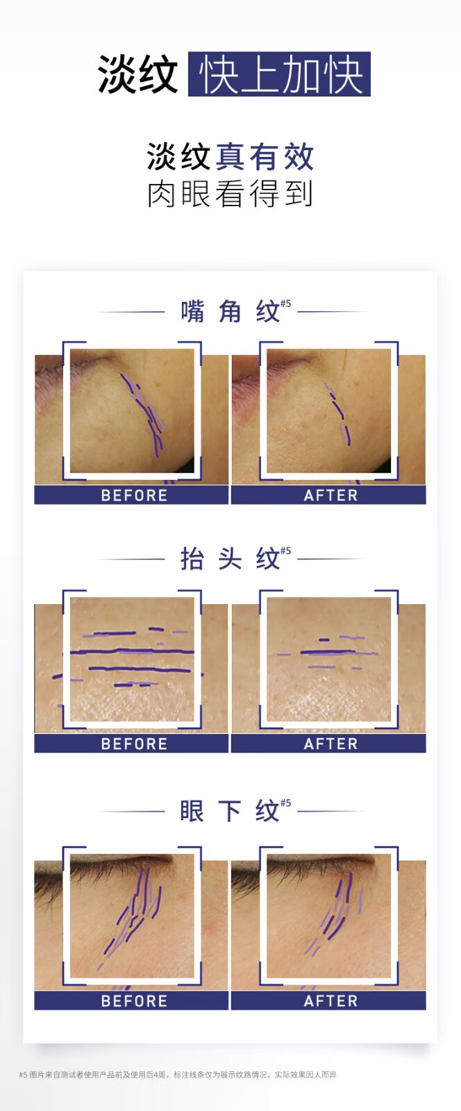 欧莱雅（L'OREAL）欧莱雅第二代紫熨斗眼霜玻色因保湿修护提拉紧致淡化细纹咖啡因 7.5ml*4【共30ml】
