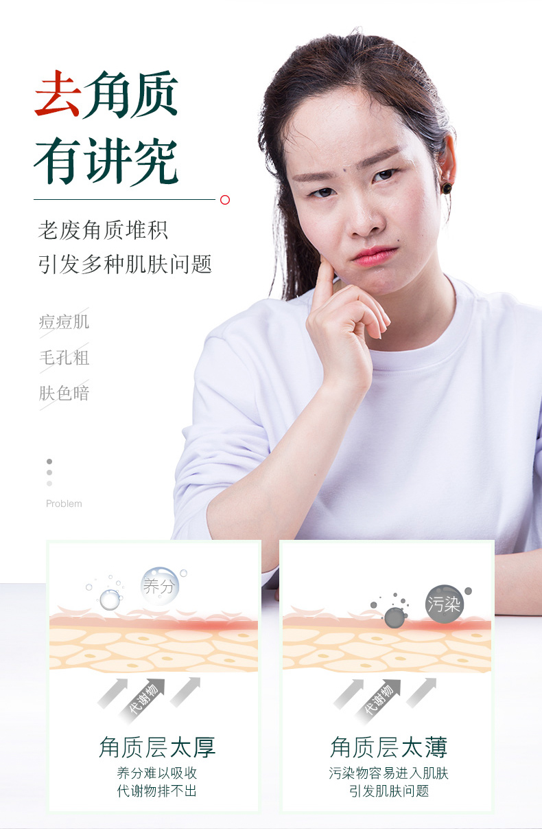 相宜本草去死皮膏补水保湿深层清洁温和去死皮面部全身女男通用去角质啫喱 去死皮膏68g