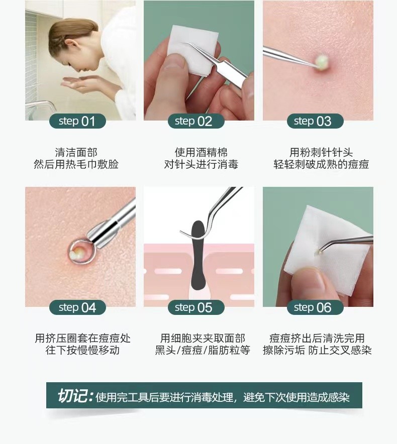 初觅 粉刺针套装细胞夹黑头针粉刺夹挤痘痘工具黑头夹暗疮针祛痘美容针挑痘挤痘针