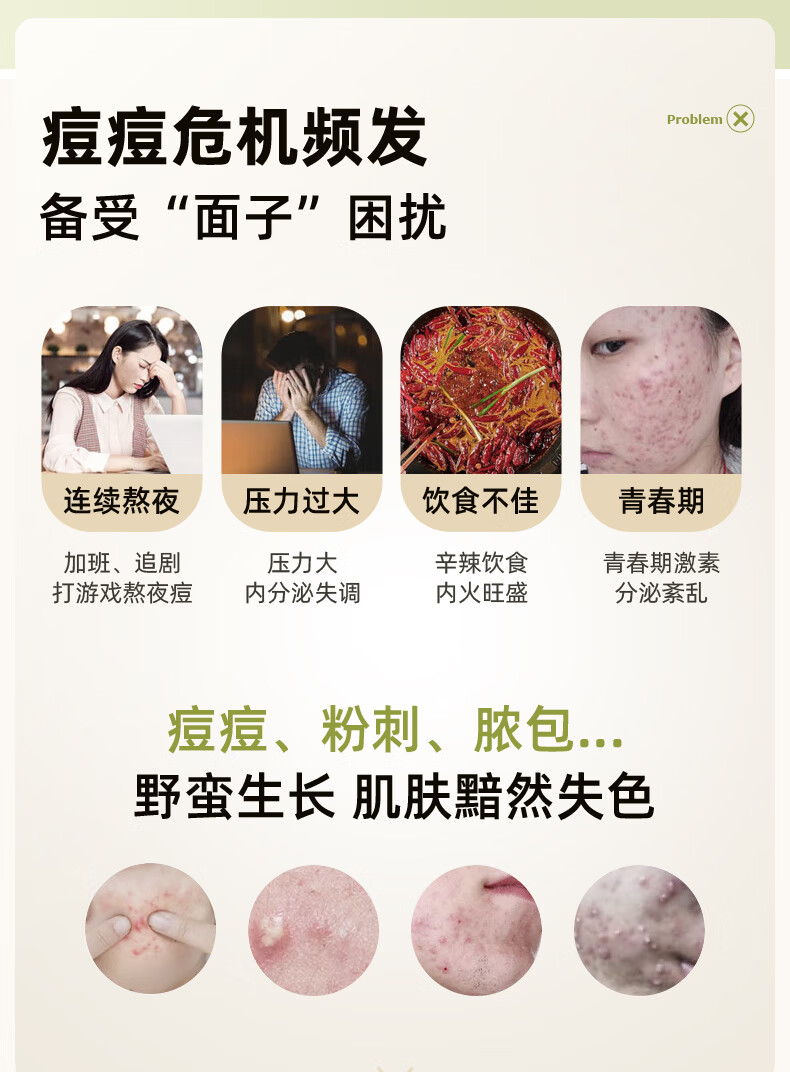 美洳活性肽祛痘精华液去祛痘印疤膏淡化痘坑修凹洞青春复痘男女士学生 一瓶标准装 30ml