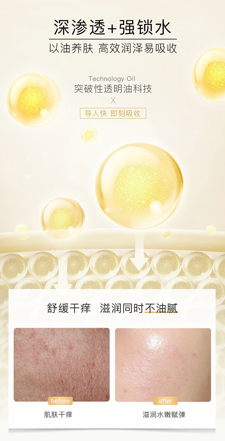 frei ol德国福来特护抚纹油无香按摩紧致润肤淡孕纹孕妇身体油护肤精华油 特护油125ml