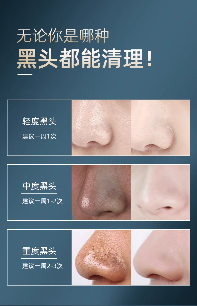 黎漾竹炭清洁黑头泥膜撕拉面膜男女士涂抹面膜黑头贴清理粉刺细致毛孔 一盒装（120g）贈2支芦荟胶