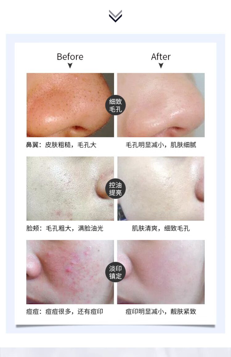 AHC 玻尿酸B5洗面奶180ml 蓝啵啵清洁毛孔泡沫控油补水洁面乳
