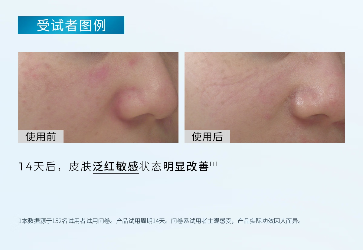 ddg维生素B5精华液面部补水保湿511精华舒缓维稳修护玻尿酸 511 B5精华30ml 30ml