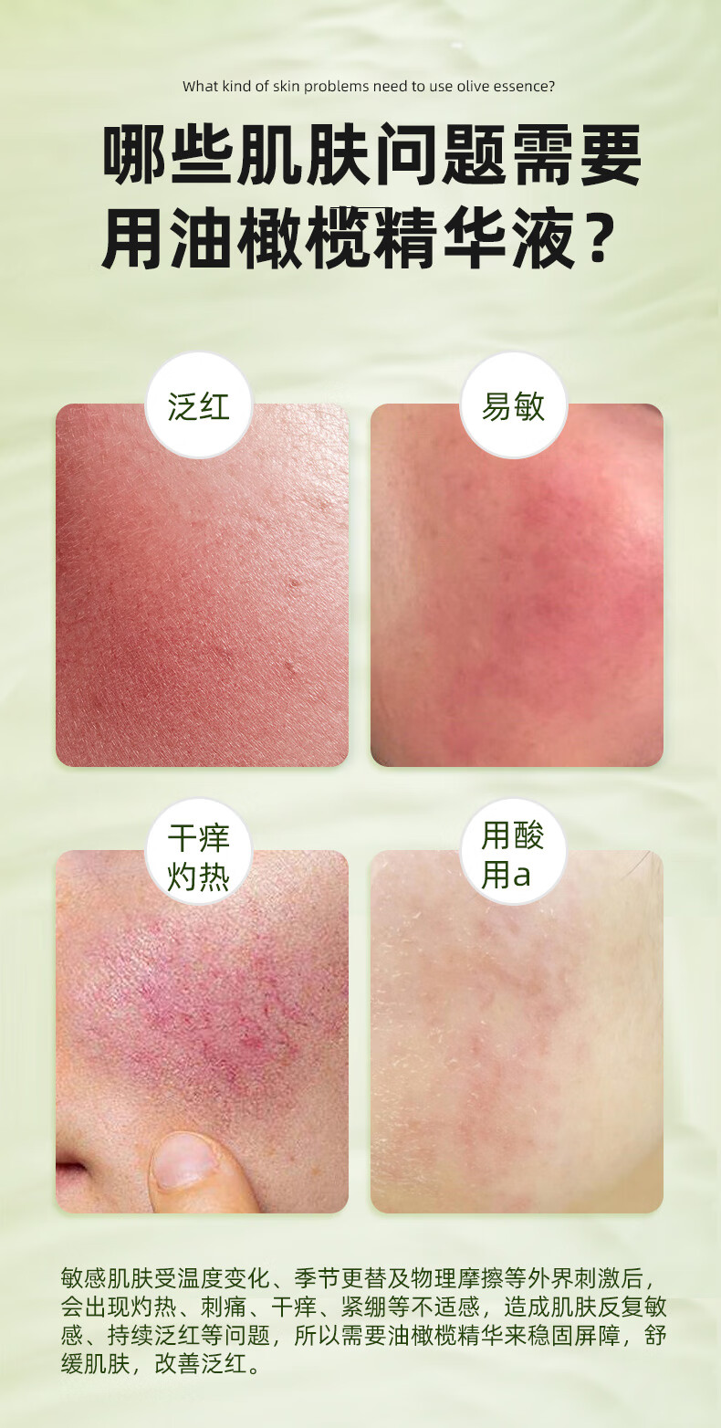 甄芙美皮肤屏障修护油橄榄舒缓精华液敏感肌激素脸泛红血丝增厚角质层 1瓶装