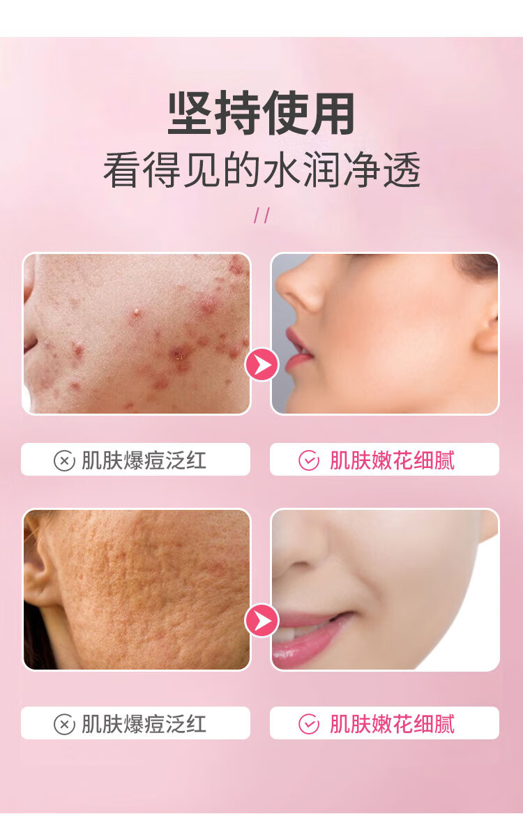 翼颜15%壬二酸凝胶软膏祛痘精华凝露水杨酸唑去淡化黑头粉刺痘印乳膏 壬二酸修护凝胶1盒