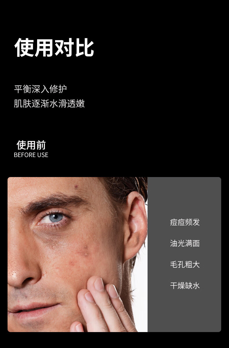 洁芙泉男士护肤品套装礼盒补水水乳套装擦脸油祛痘洗面奶生日礼物送男友 礼盒四件套