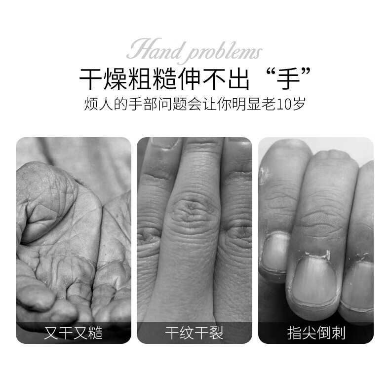 金妮雅（KNIYEA）花果植萃精华护手霜男女士滋润嫩肤保湿冬季防干冻裂护手润手乳霜 植萃护手霜 30g 5支【随机香味】