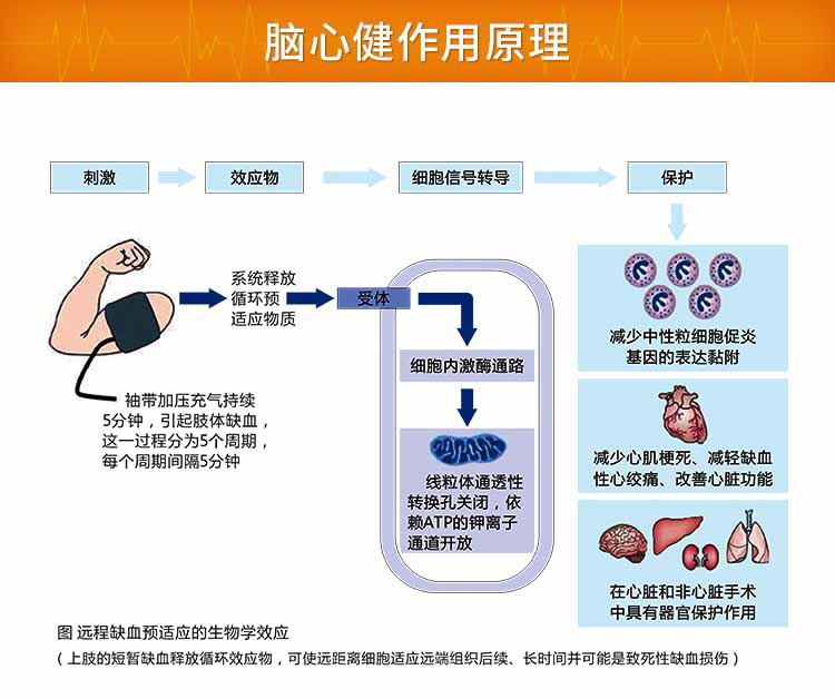 tdft 脑心健远程缺血预适应训练仪 脑中风康复治疗仪