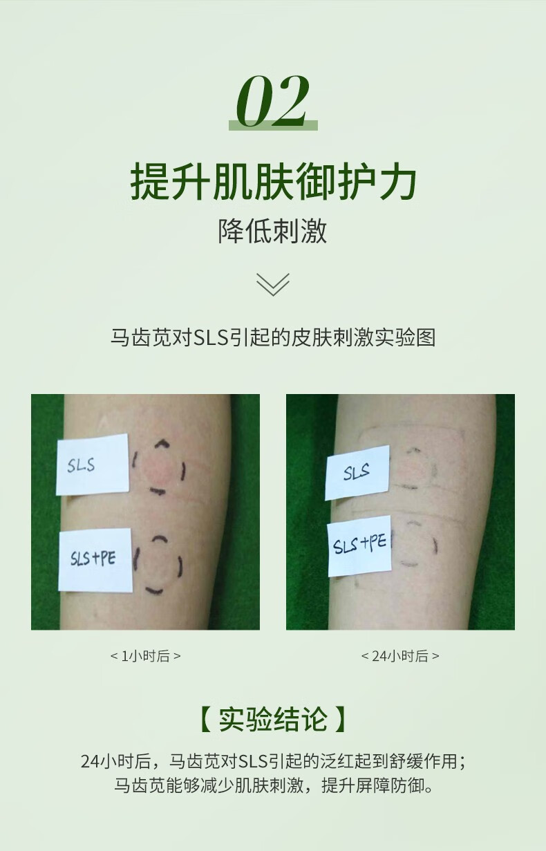 孔凤春马齿苋净痘精华液祛痘祛闭口粉刺呵护加速催熟瘪痘男女学生通用 30ml