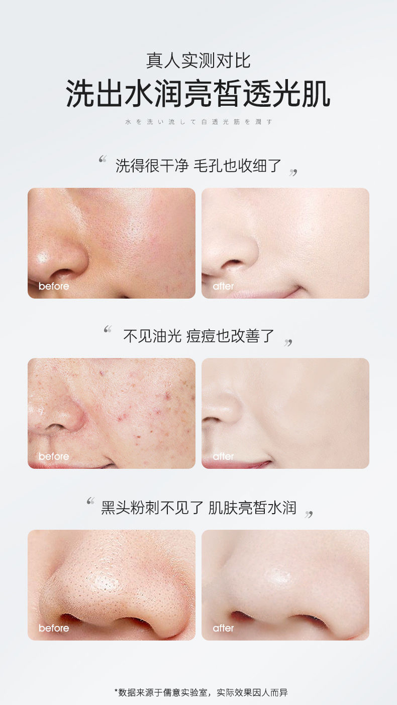 儒意（RUYI）氨基酸洗面奶女温和清洁控油保湿不紧绷敏感肌泡泡洁面慕斯300ml 【新客尝鲜】洁面泡泡300ml*1瓶