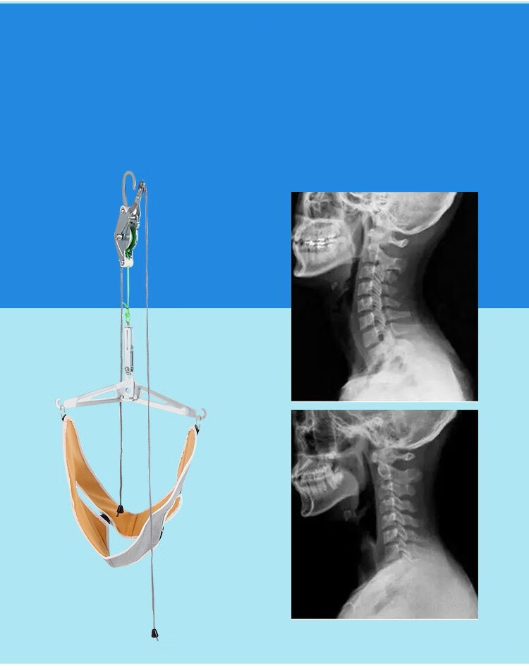 挂钩式颈椎家用吊脖子疼劲护颈椎牵引架拉伸带颈部椅护颈托治疗拉伸器