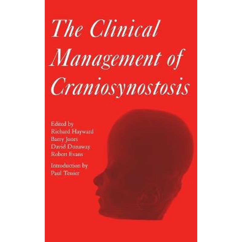 按需印刷The Clinical Management of Craniosynostosis[9781898683360]