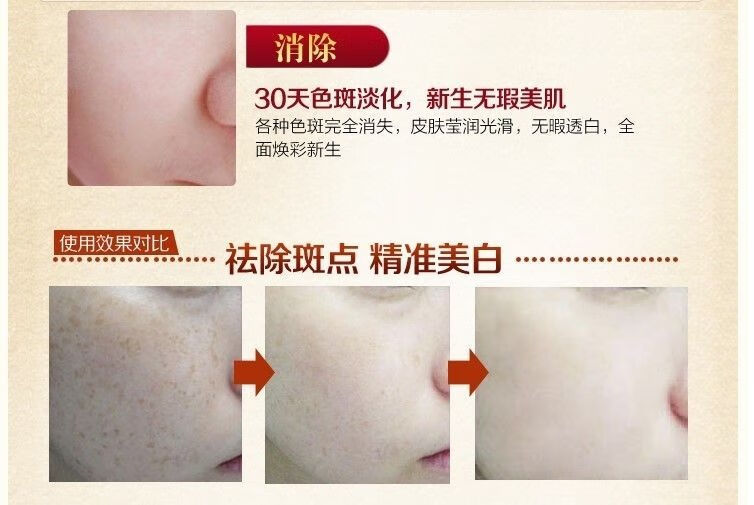 韩泊莉笑影冬虫夏草二合一美白祛斑霜套装淡斑保湿黄褐斑雀斑化妆品 日霜+日霜