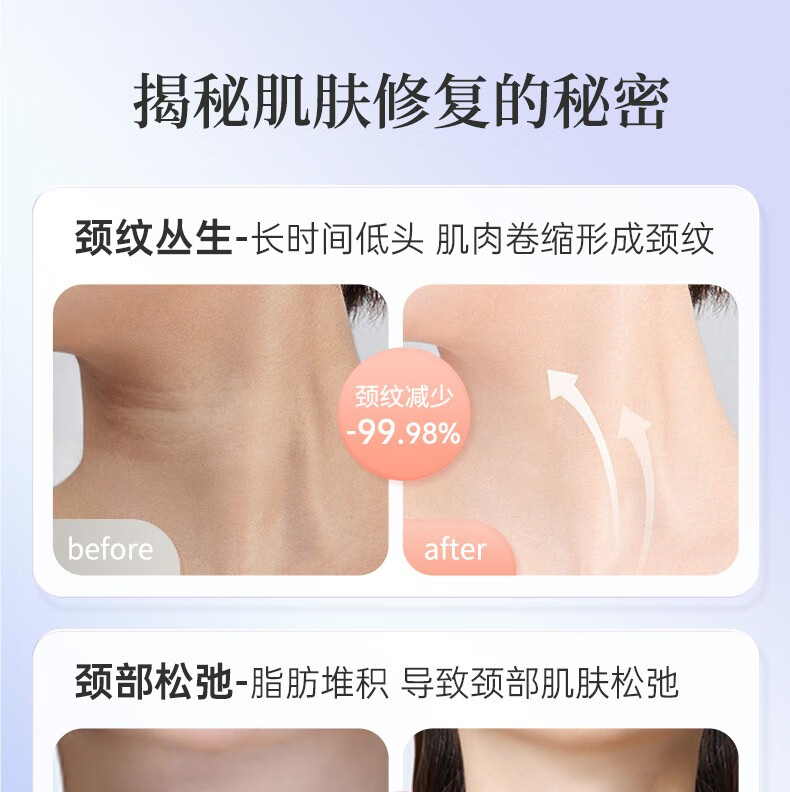 妮丽雅定制款颈膜固定带可水洗颈部敷脖子面膜颈带绑带颈纹带辅助工具 香芋粉黛【不卡不勒脖子】