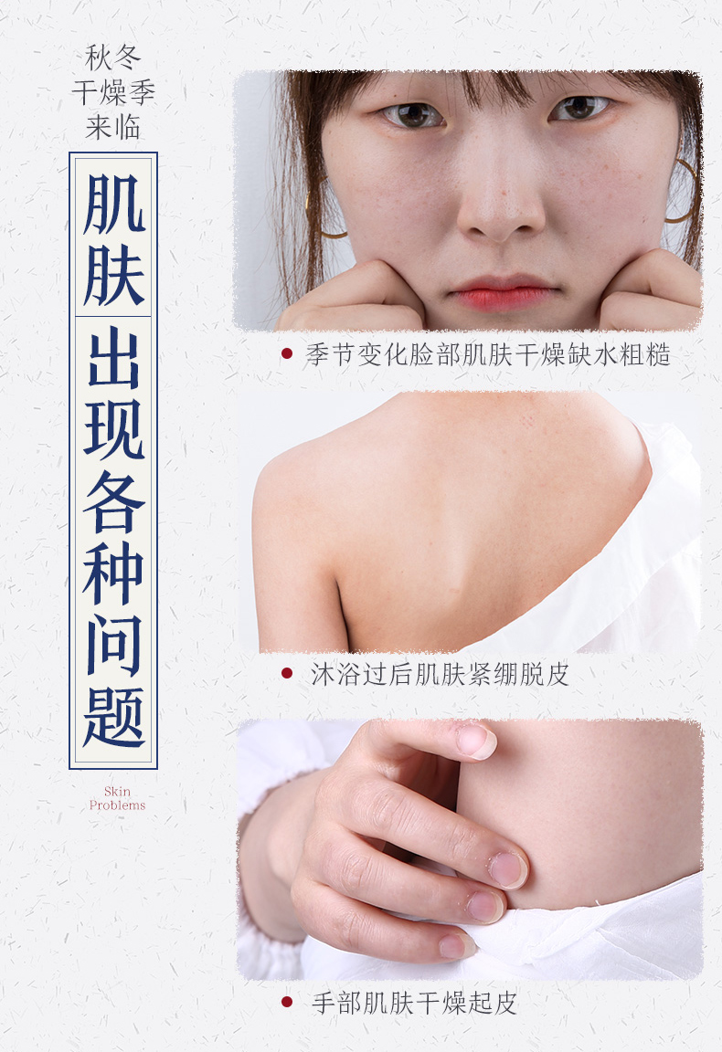 百雀羚（PECHOIN） 乳液SOD蜜护肤品维他芦荟补水保湿秋冬擦脸霜滋润 SOD蜜150g*2瓶【维他保湿】