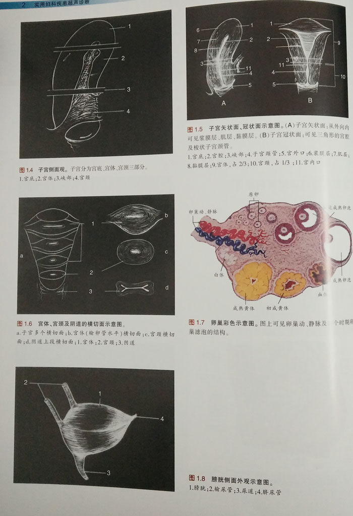 《正版 实用妇科疾患超声诊断 (附3张光盘)吴钟瑜 张志坤编 天津科技