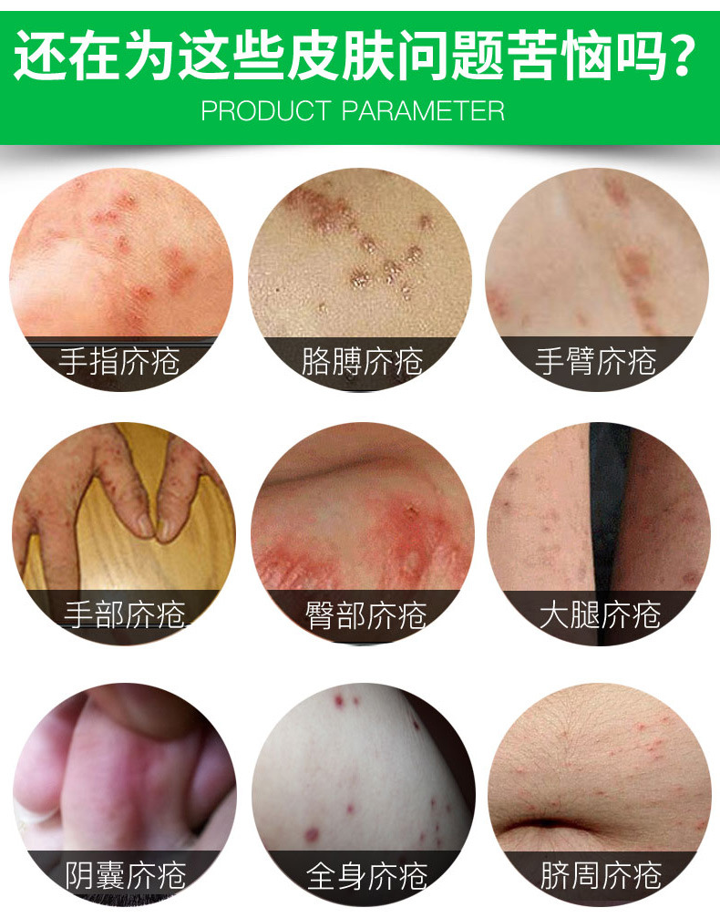 雅美肤草本疥疮膏皮肤外用疥虫疥疮药膏儿童成人蚊虫咬叮止痒疥虱康宁