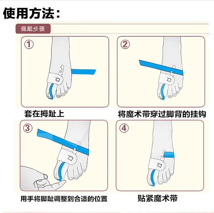 
                                        木阿阿 2个装拇指外翻护理套 防止挤压重叠护理套 改善拇外翻拇外翻矫正器夜用 大脚骨矫正器 1对装蓝色带子蓝色垫片                