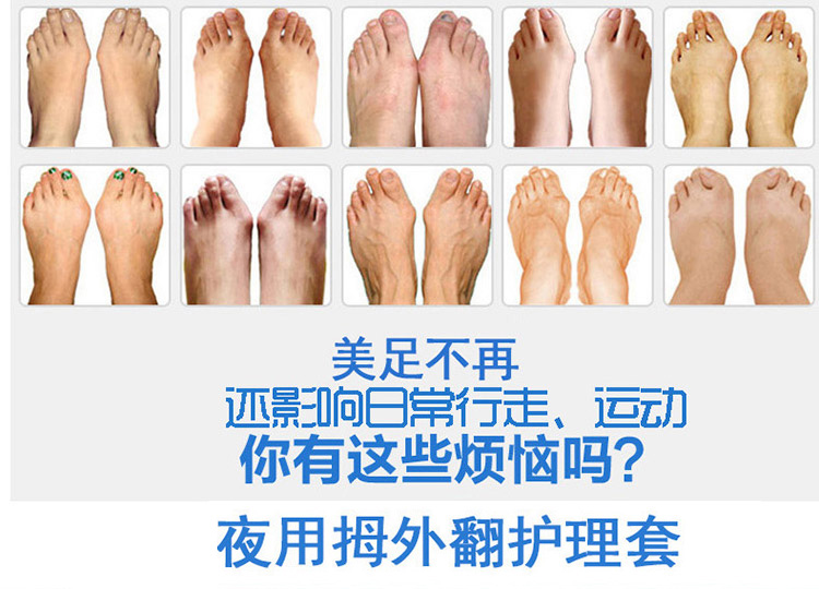 
                                        木阿阿 2个装拇指外翻护理套 防止挤压重叠护理套 改善拇外翻拇外翻矫正器夜用 大脚骨矫正器 1对装蓝色带子蓝色垫片                