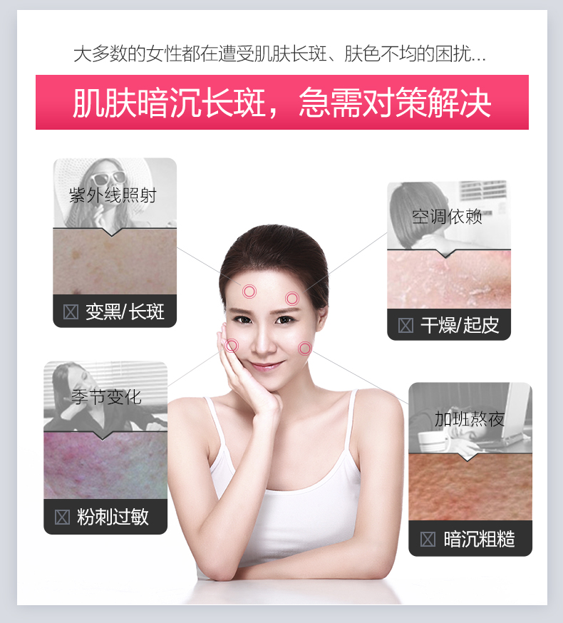 瓷肌（SPA CHNSKIN） 祛斑美白套装淡黄亮肤补水保湿化妆品男女护肤品