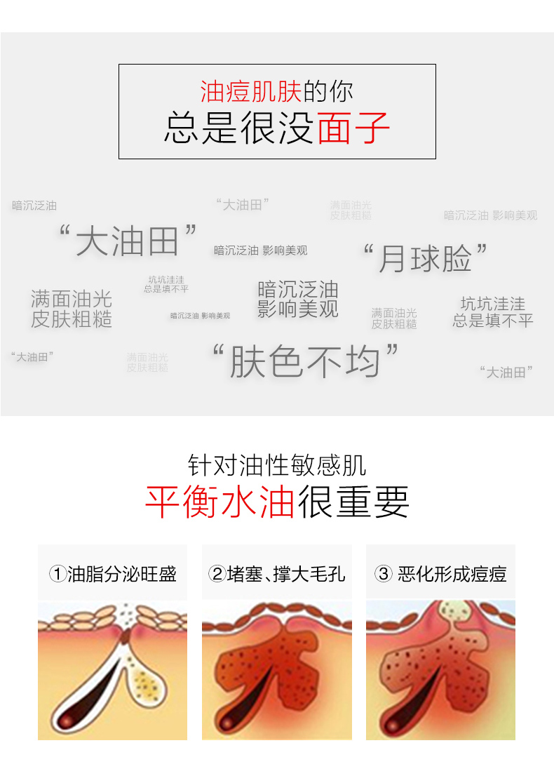 薇诺娜 舒缓控油凝露50g（效期剩余6个月）