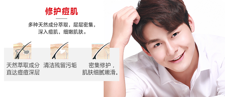 瓷肌（SPA CHNSKIN） 净颜清痘套装(男女士中度)淡化痘印控油补水收缩毛孔深层清洁护肤品学生
