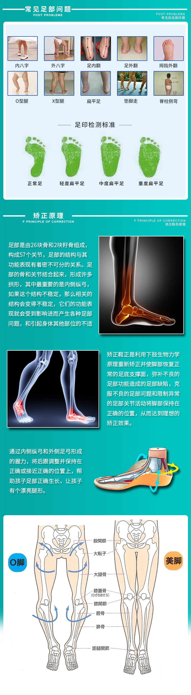 太子豹内八字矫正鞋儿童 xo型腿 足外翻扁平足矫正鞋垫脚走马蹄足足