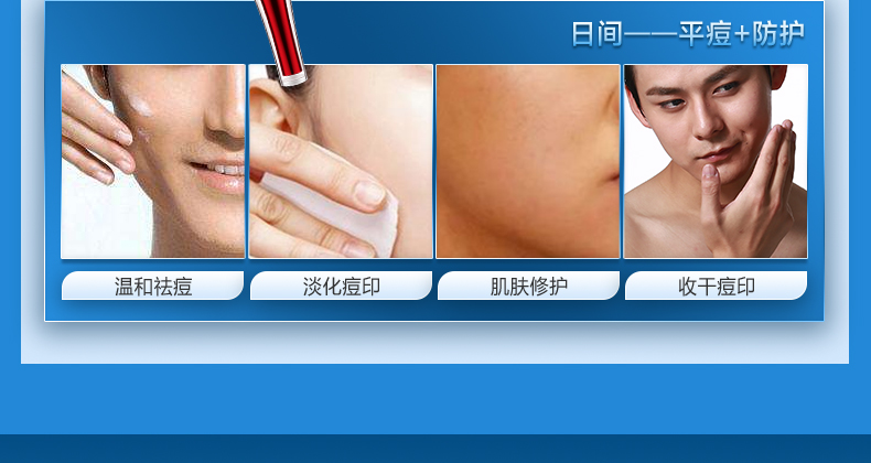 瓷肌（SPA CHNSKIN） 净颜清痘套装(男女士重度) 淡化痘印清洁控油收缩毛孔护肤品
