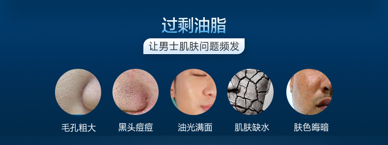 瓷肌（SPA CHNSKIN） 净颜清痘套装(男女士重度) 淡化痘印清洁控油收缩毛孔护肤品