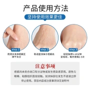 Pumadi Bark Scar Removing Cream Scar Spirit Repair Medical Children Adult Caesarean Section New and Old Scars Facial Acne Print Buck Scar Gel Scar Gel Medical Silicone Scar Gel 20g/Touch Trial Pack