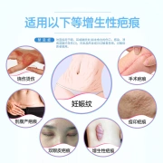 Pumadi Bark Scar Removing Cream Scar Spirit Repair Medical Children Adult Caesarean Section New and Old Scars Facial Acne Print Buck Scar Gel Scar Gel Medical Silicone Scar Gel 20g/Touch Trial Pack