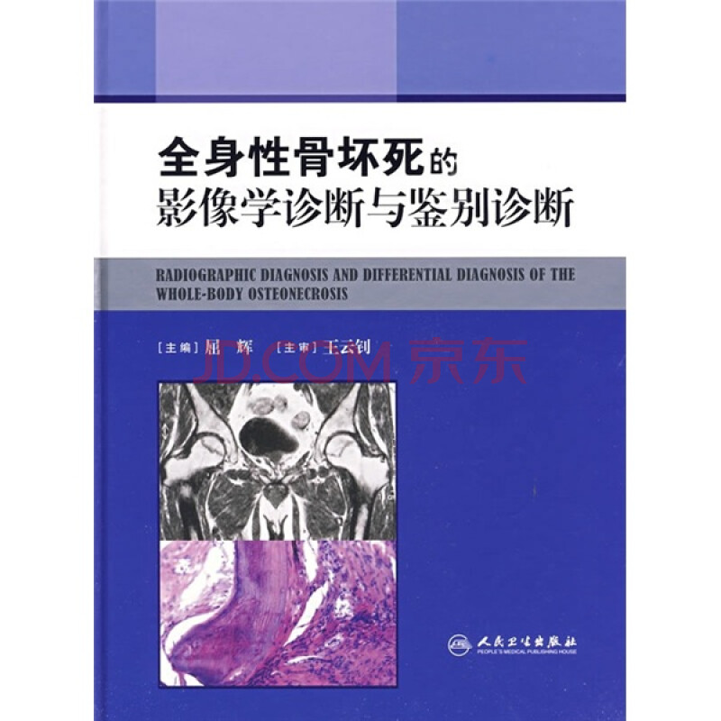 全身性骨坏死的影像学诊断与鉴别诊断 屈辉 人