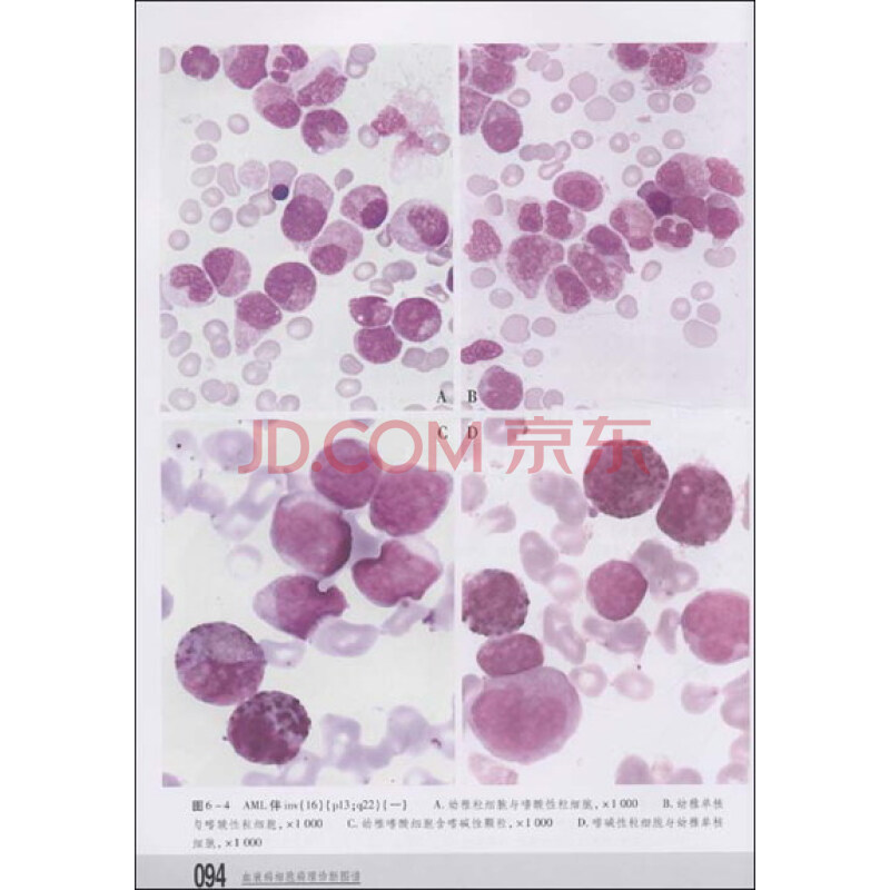 血液病细胞病理诊断图谱