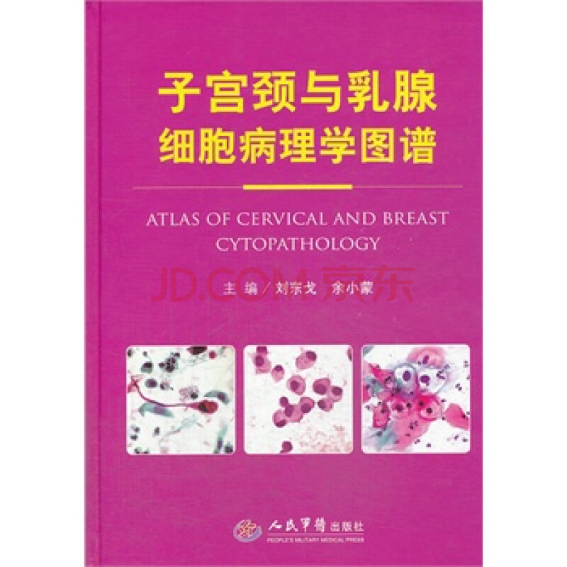 子宫颈与乳腺细胞病理学图谱 刘东戈,余小蒙 人