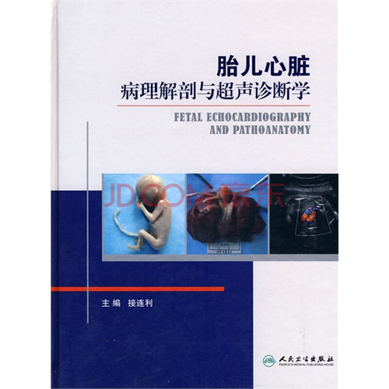 胎儿心脏病理解剖与超声诊断学图片