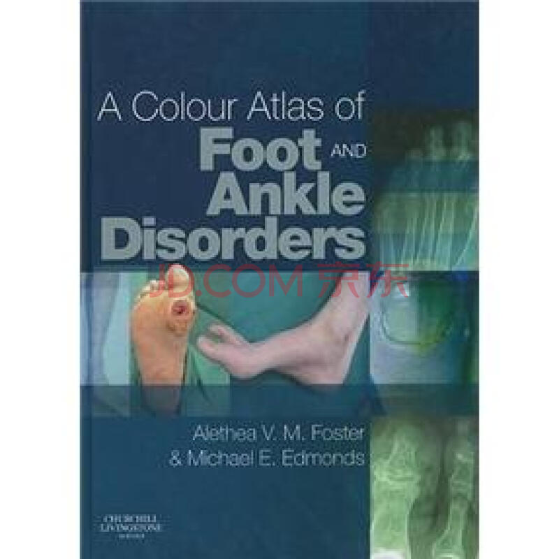 a colour atlas of foot and ankle disorders [精装][足踝疾病彩色