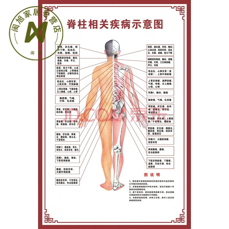 脊柱相关疾病人体脊椎全息图健康速查表美容院装饰画中医馆挂图 脊柱
