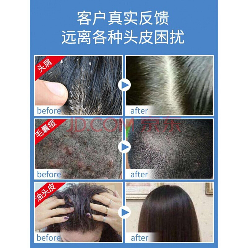 【官方旗舰】淳紫乐康洗发水发液液洗发水毛囊去屑止痒 一盒装 .