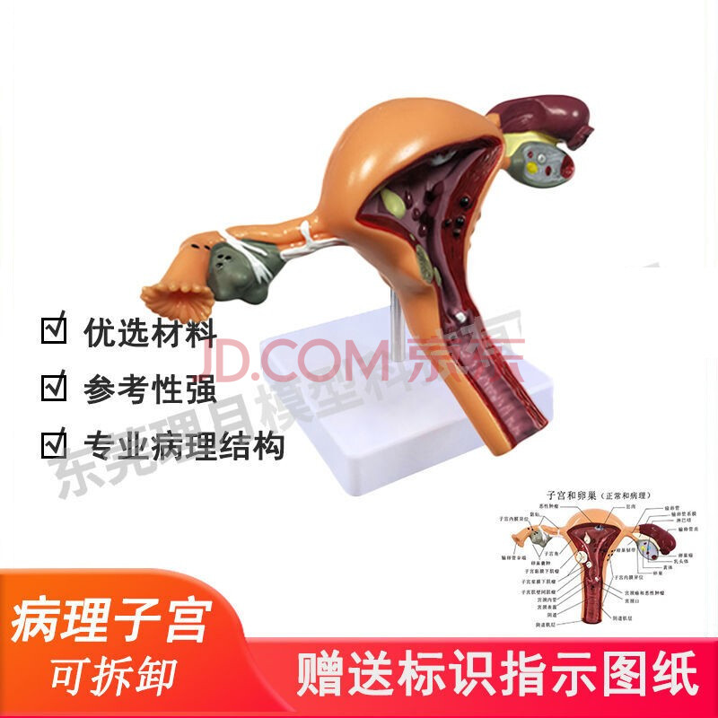人体子宫模型教具模具阴道卵巢解剖病理医学女性仿真女性生殖模器