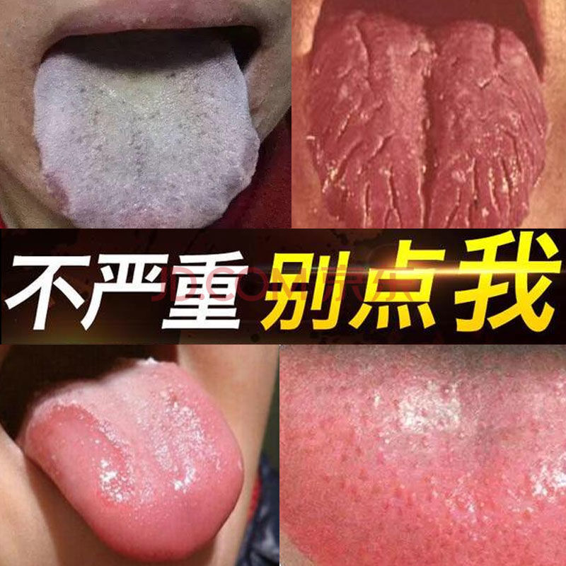 舌炎舌头起泡口腔黏膜发白口腔扁平苔i藓粗糙疼痛灼伤